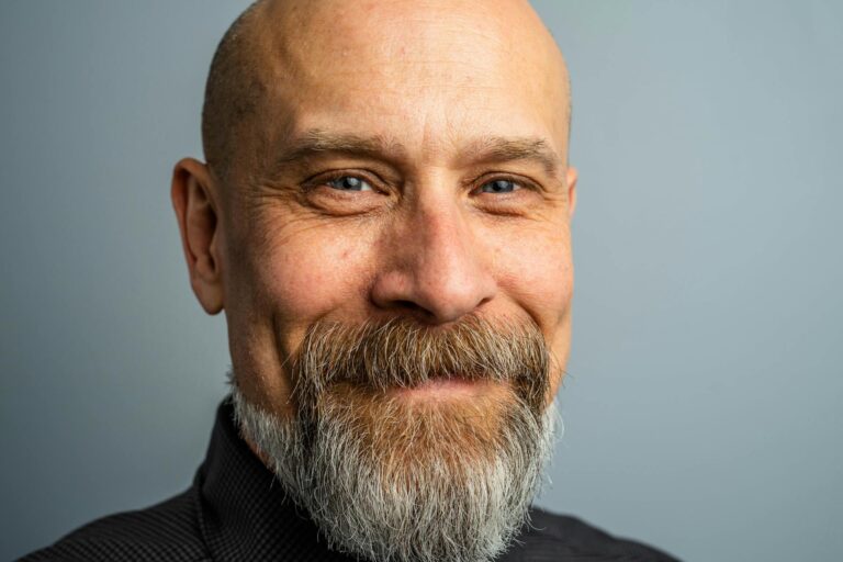 Falten im Gesicht – Welche Arten und Behandlungen gibt es?