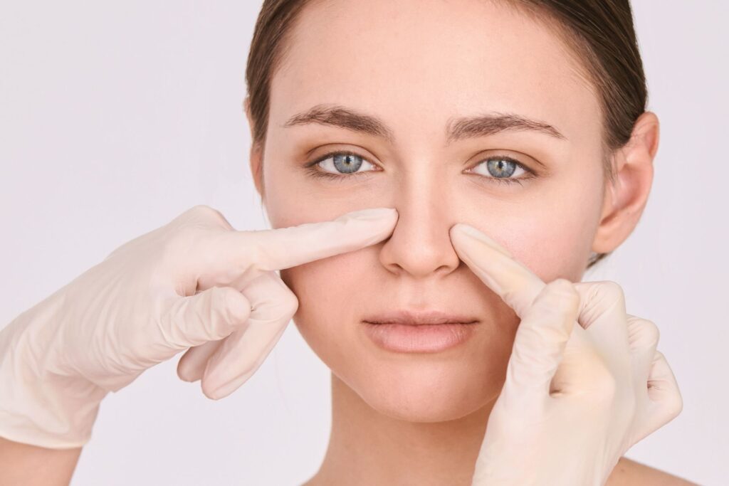 Verschmälerung des Nasenrückens – für eine feine und elegante Nasenlinie
