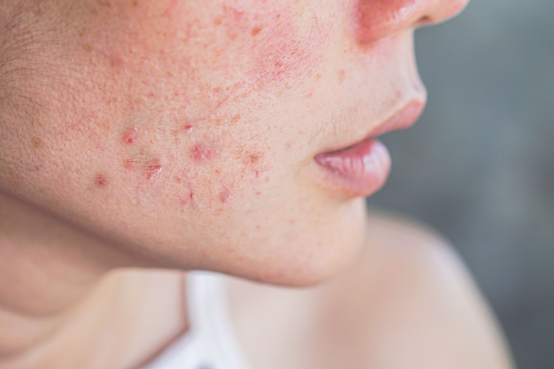 Für wen eignet sich die Narbenbehandlung?
