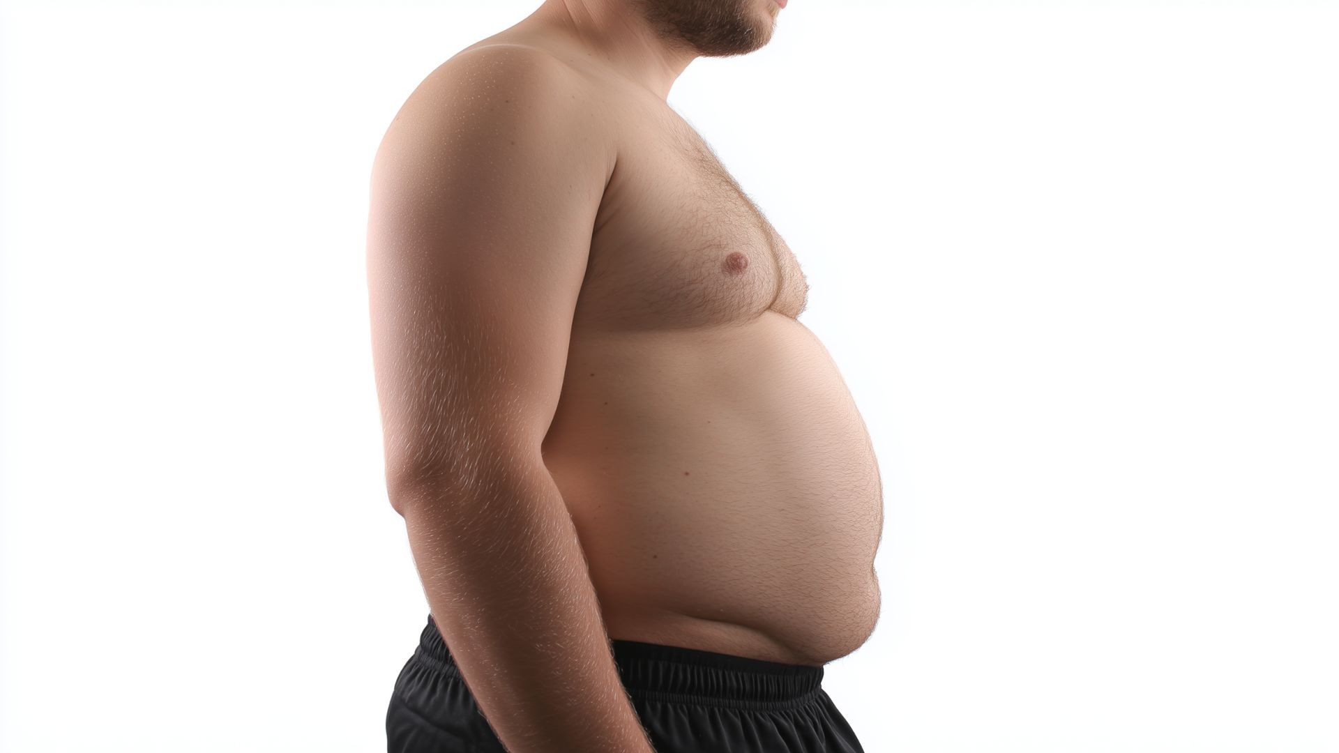 Bauchstraffung oder Fettabsaugung?